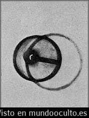 Otra radiografía del objeto de Coso cuya apariencia de bujía solo es aparente   El artefacto de coso
